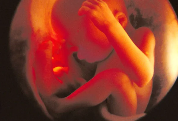 Ultrasound