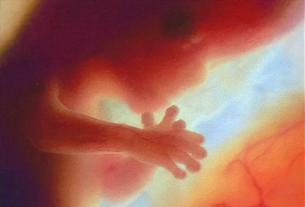 Ultrasound