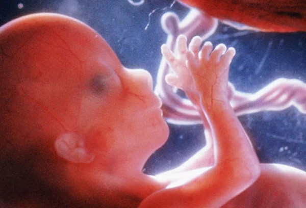 Ultrasound