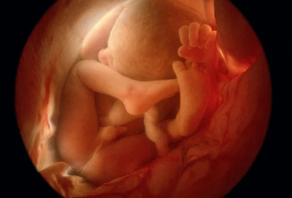 Ultrasound