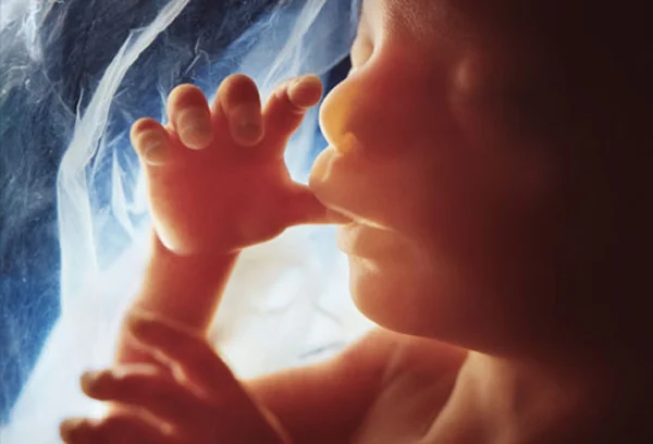 Ultrasound