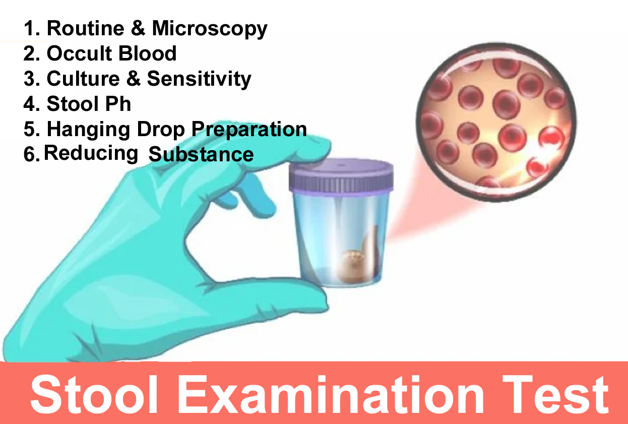 Stool Exam