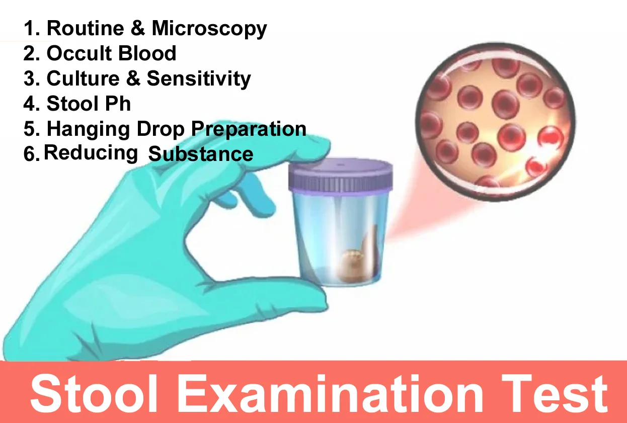 Stool Exam