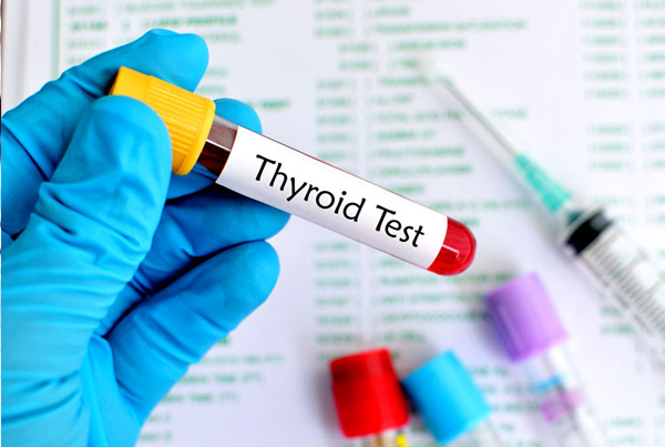 Thyroid Panel