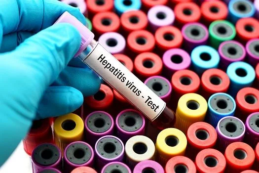Hepatitis Profile