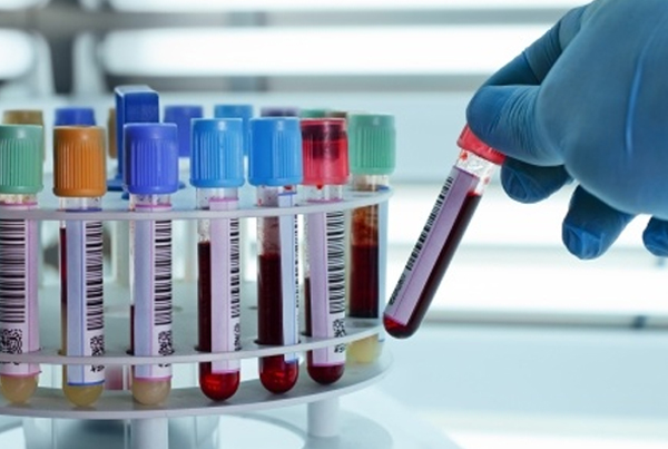 Culture and Antibiotic