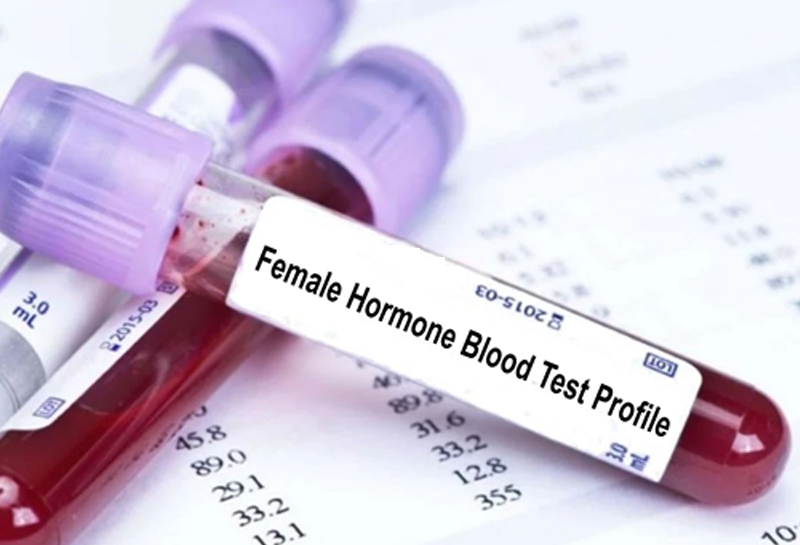 Hormone Test